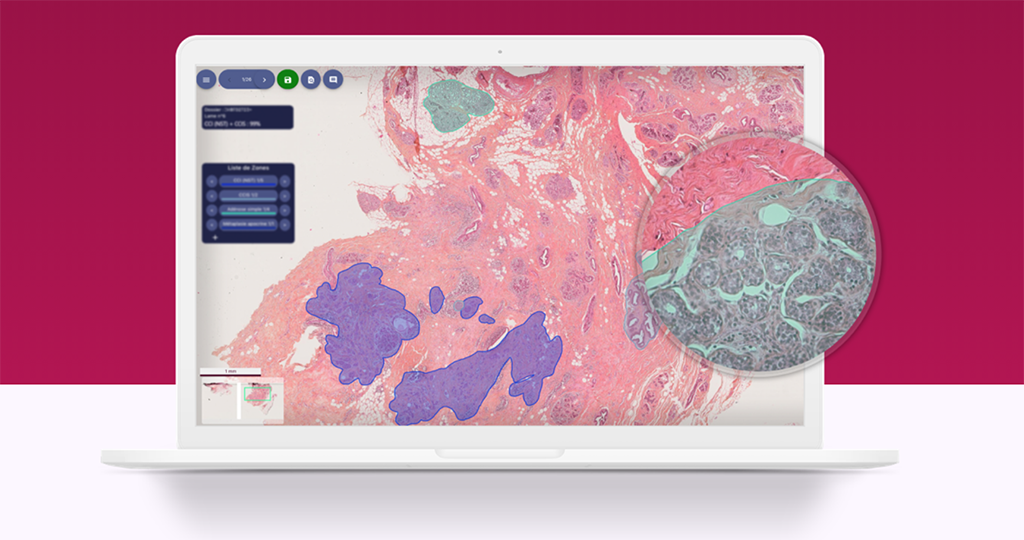 Primaa: automatização do diagnóstico histológico de cancro - SuperToast